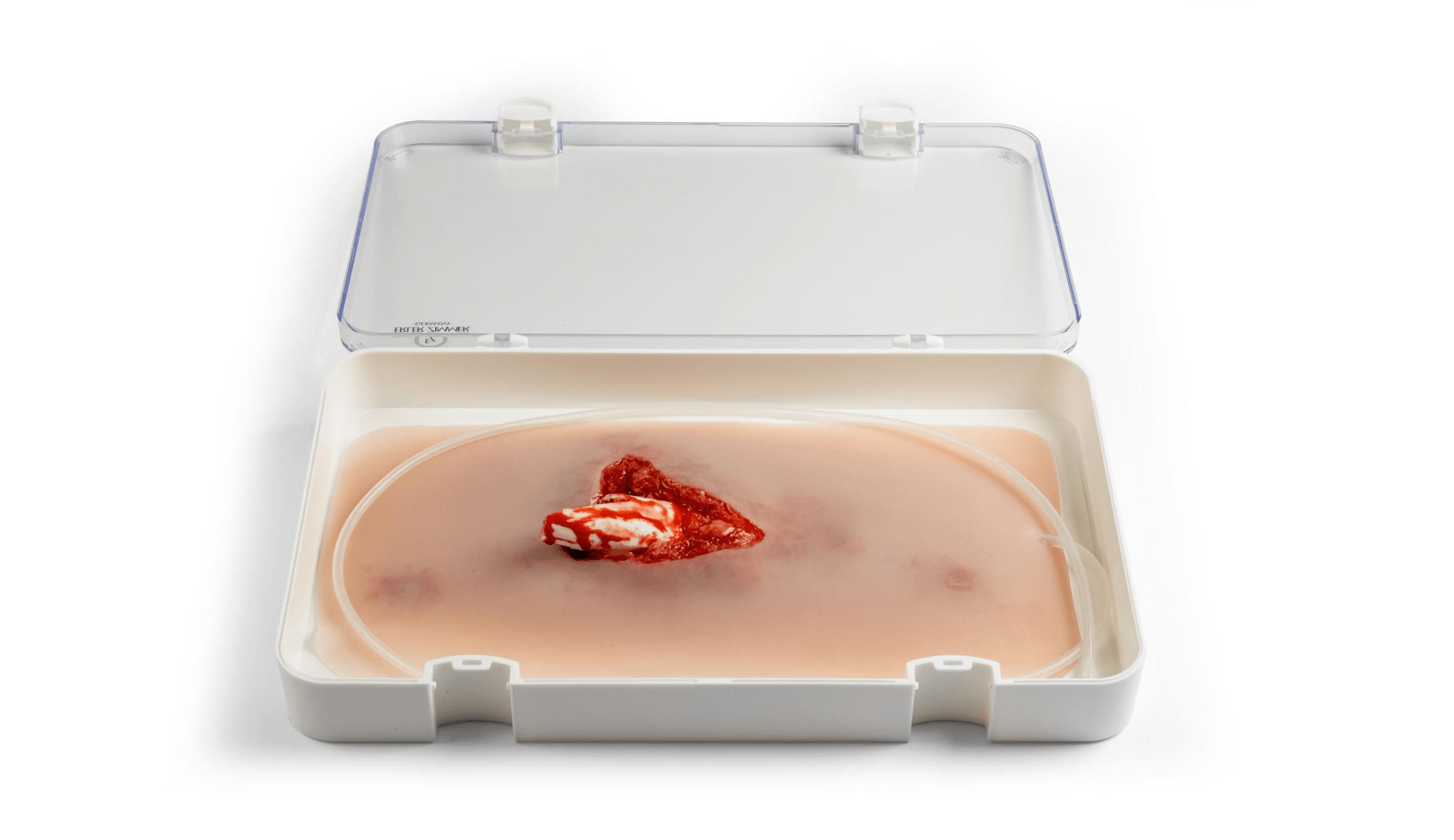 Offener Bruch Bein mit Blutungsfunktion - Erler - Zimmer